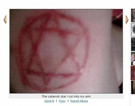 satanist star Satanic Star of David Scarring or Self Inflicted Tattoo 