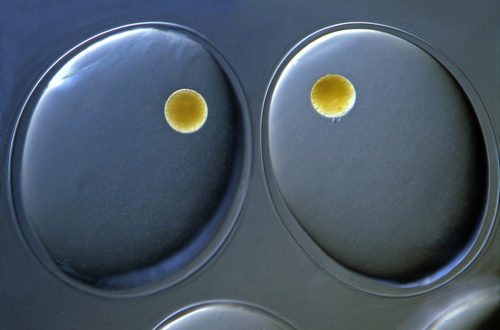 Microscopic Beauty of Photography's 00x_09brizzi16580web Microscopic Beauty of Photography's 00x_09brizzi16580web