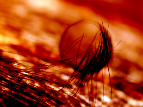 Microscopic Beauty of Photography's holtermannweb Microscopic Beauty of Photography's holtermannweb